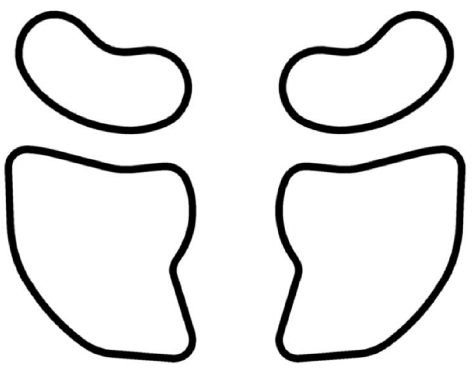 エステマスク・各種